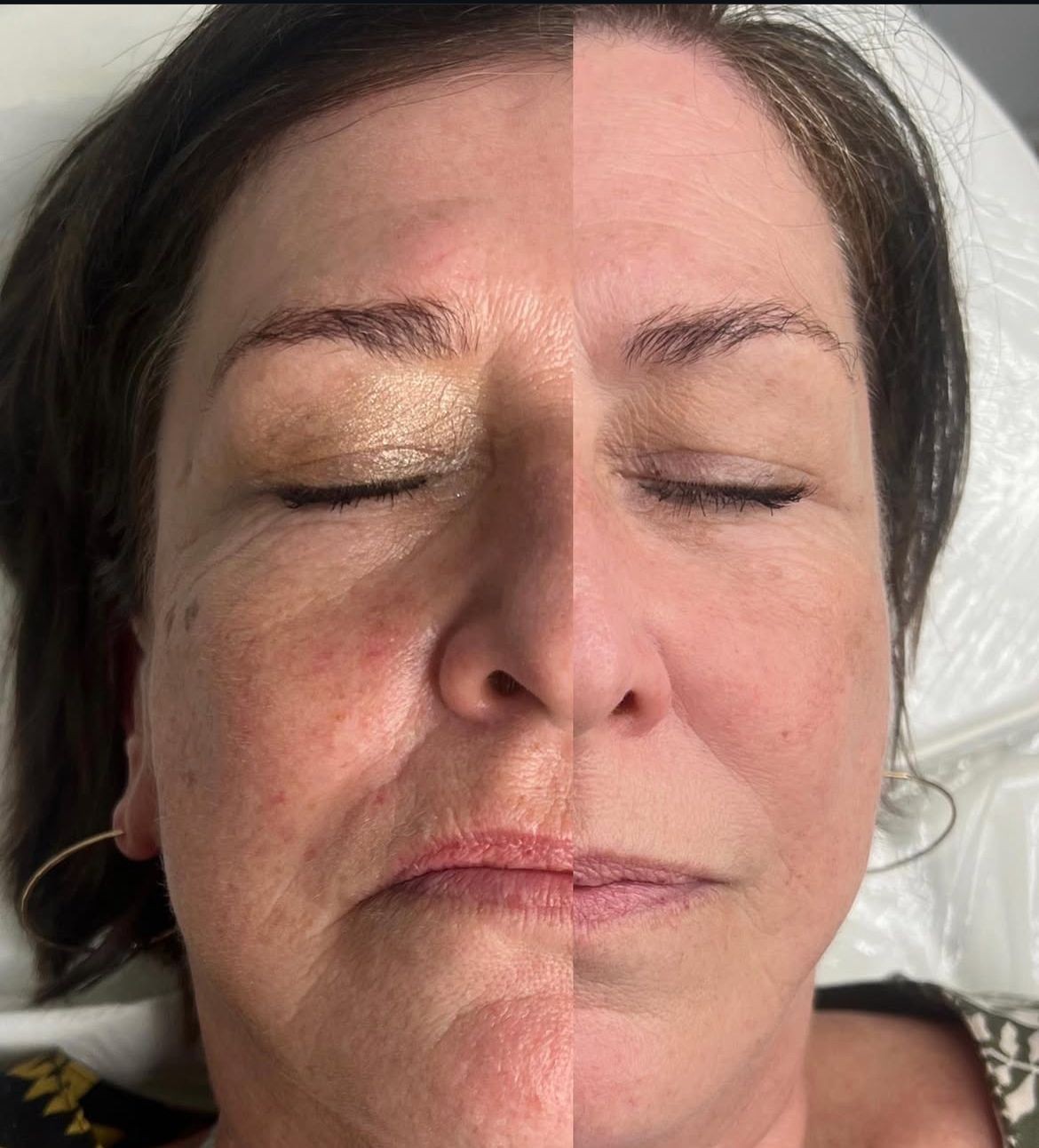 Advanced Anti-Aging Facials